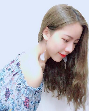 北京藝星王英勇隆鼻案例 鼻綜合三個月